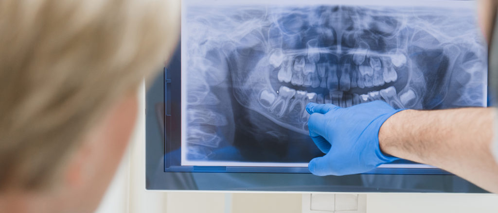 Praxis für Kiefer-Gesichts-Chirurgie und Ästhetik Dr. Meurer Vechta – Röntgenbild Zähne und Kiefer