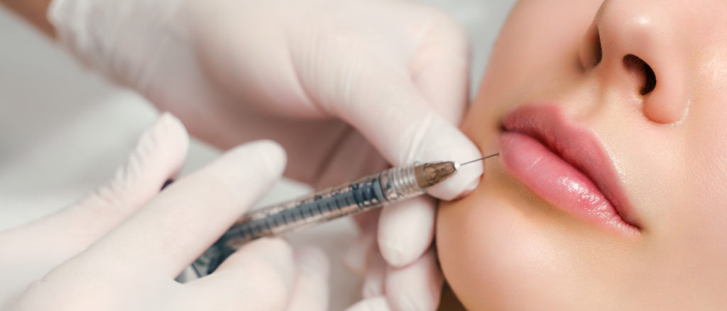 Praxis für Kiefer-Gesichts-Chirurgie und Ästhetik Dr. Meurer Vechta – Hyaluron zum Lippen aufspritzen